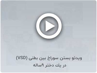  ویدئو بستن سوراخ بین بطنی (VSD) در يك دختر 9ساله